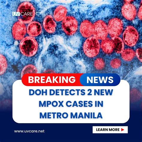 DOH detects 2 more mpox cases in Metro Manila.